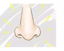 鼻翼縮小手術是怎么做的