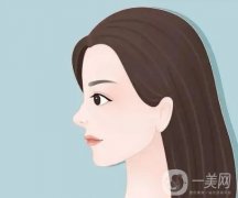 鼻翼切除術后怎么正確護理消腫