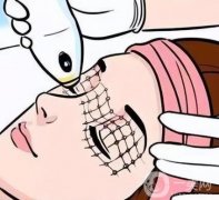 超聲刀的效果及后遺癥