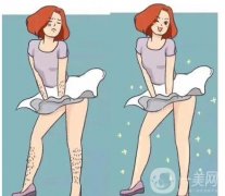 超冰脫毛需要做多少次