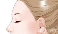 提眉手術(shù)與雙眼皮手術(shù)需要間隔多久？