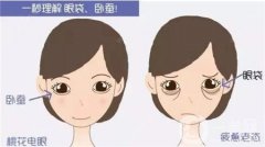 眼袋修復(fù)的方法有哪些？