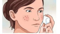 眼窩填充后的恢復(fù)時(shí)間和流程