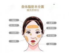 怎么緩解自體脂肪填充后的疼痛