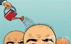 植發(fā)術(shù)后有什么副作用