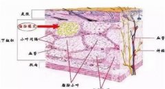 自體脂肪豐蘋果肌的優(yōu)點