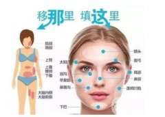 自體脂肪填充額頭有什么缺點？