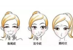 做線雕蛋白線如何呢？