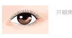 開(kāi)眼角手術(shù)后吸煙的危害