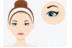 開(kāi)眼角術(shù)后洗臉有哪些注意事項(xiàng)