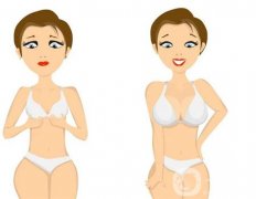 哪些人適合進(jìn)行麥格假體隆胸手術(shù)？