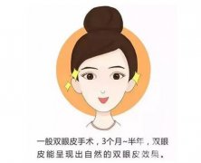 哪些人適合進(jìn)行雙眼皮手術(shù)