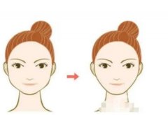 切骨手術(shù)怎么樣，有潛在風(fēng)險(xiǎn)嗎