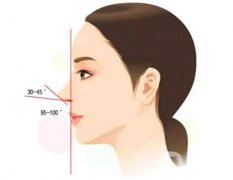 膨體隆鼻后取出是否真的困難？