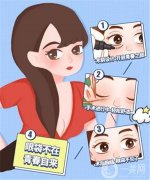 祛眼袋手術的費及失敗的處理方法