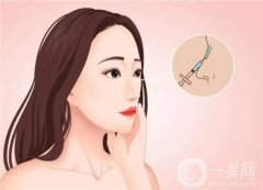 如何避免激光祛斑后反黑現(xiàn)象