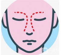 如何避免鼻頭縮小手術(shù)后的增生呢？