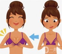 乳暈縮小手術(shù)的效果如何呢？
