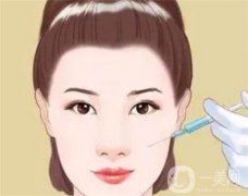 玻尿酸的種類及作用